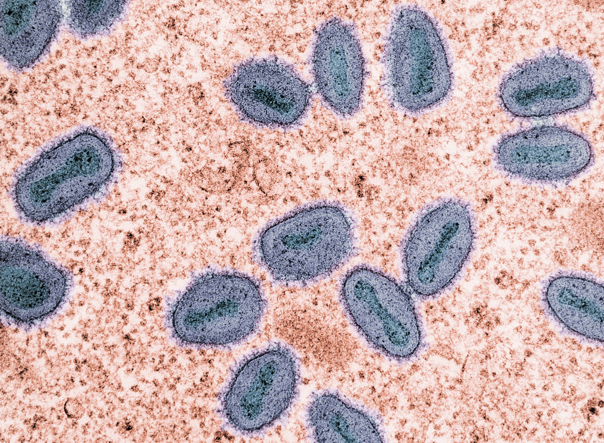 Close up of Monkeypox virus cells